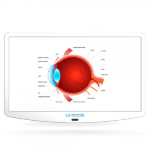 Unicos Visiusscherm ULC-900P zomer aanbieding